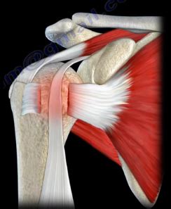 transverse humeral ligament tear test|shoulder pain radiating to bicep.